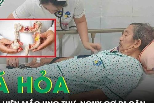 Tái khám tim mạch, người đàn ông tá hỏa phát hiện mắc ung thư biểu mô, nguy cơ di căn