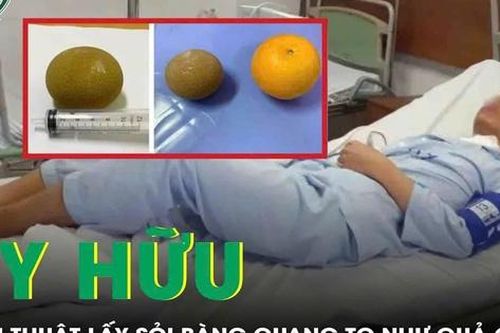 Phẫu thuật lấy sỏi bàng quang to như quả cam cho bệnh nhân 69 tuổi