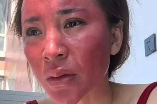 Không tẩy trang suốt 22 năm, người phụ nữ gây sốc khi mặt bị biến dạng