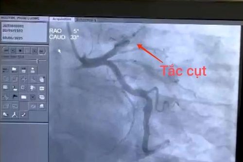 Trả 'giá đắt' khi hút 2 bao thuốc lá một ngày