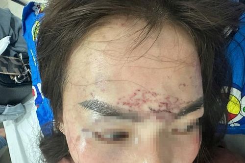Diễn biến mới vụ người phụ nữ bị cắt tóc, xăm mặt ở Cà Mau