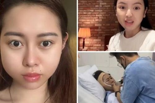 Mỹ nhân Việt khổ sở vì tiêm filler hỏng, tốn nhiều tiền để sửa sai