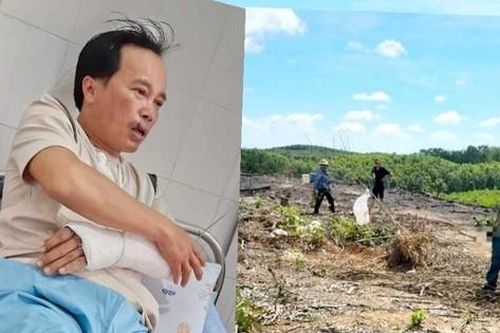 Góc nhìn pháp lý vụ việc 1 cán bộ bảo vệ rừng bị đánh nhập viện ở Quảng Trị