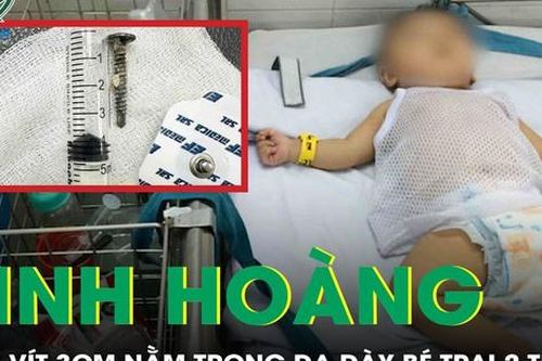 Kinh hoàng: Phẫu thuật lấy đinh vít dài 3cm trong dạ dày bé trai 29 tháng tuổi