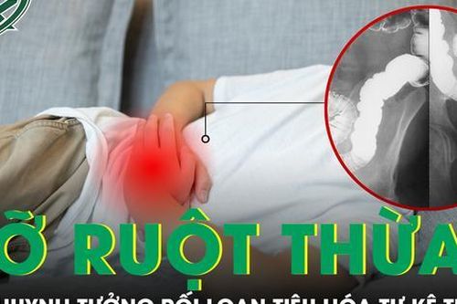 Tự điều trị đau bụng tại nhà, bé trai bị vỡ ruột thừa