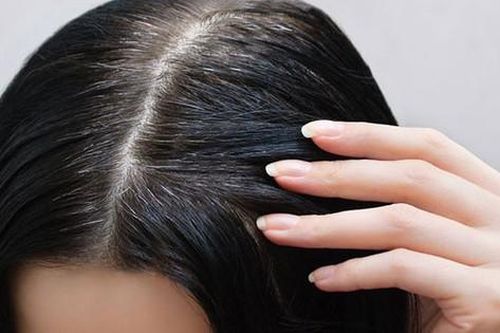 Nên ăn gì để làm đen tóc?