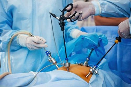 Chữa sỏi mật hiệu quả có cần mổ?