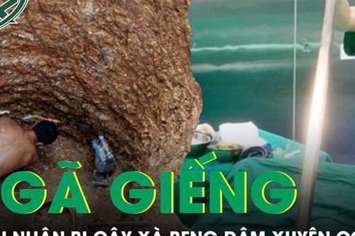 Người đàn ông bị xà beng đâm xuyên cơ thể do bất cẩn ngã xuống giếng