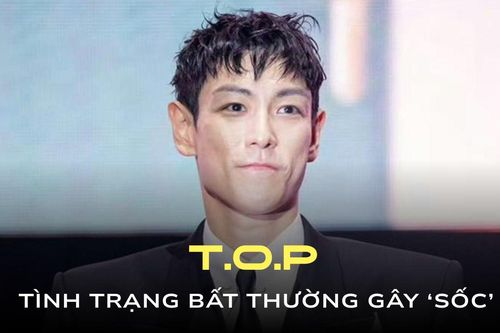 Trạng thái bất thường của T.O.P (BIGBANG)