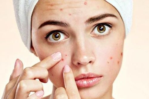 Nguy cơ tử vong từ thói quen tự nặn mụn