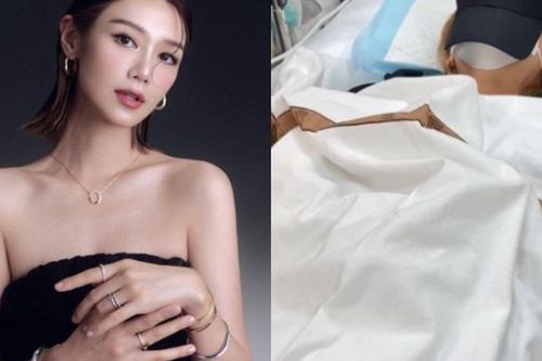 Mặt nạ ngọc trai khiến Nghê Thần Hy suýt mất thị giác trong đêm