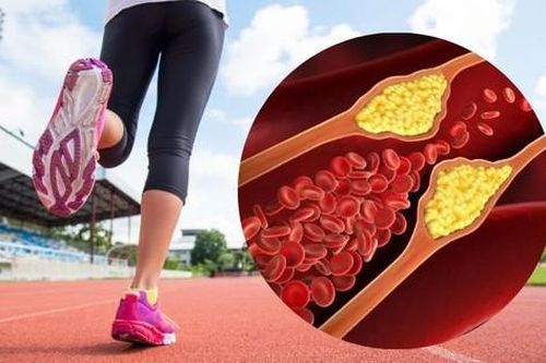 Cần đi bộ bao nhiêu để hạ cholesterol?