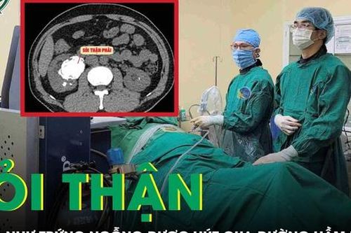 Phẫu thuật lấy sỏi thận to như quả trứng ngỗng cho người đàn ông 47 tuổi