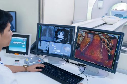 TPHCM có siêu máy chụp CT hơn 100.000 lát cắt, quét toàn thân chưa đến 2 giây