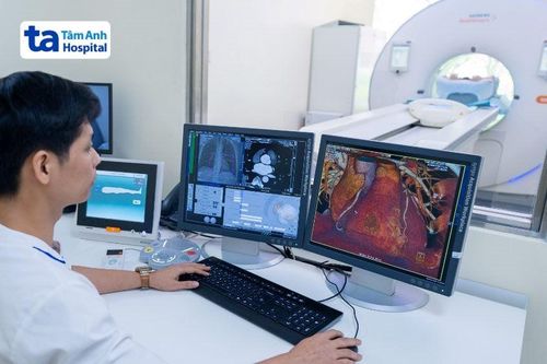 Chính thức đưa vào hoạt động 'siêu máy' CT hơn 100.000 lát cắt giúp phát hiện sớm bệnh lý nguy hiểm
