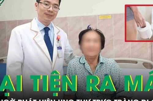 Đại tiện ra máu suốt 2 tháng, người phụ nữ phát hiện ung thư trực tràng di căn