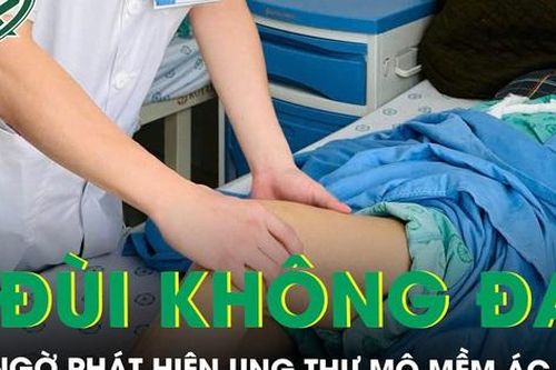 U đùi không đau đi khám bất ngờ phát hiện ung thư mô mềm ác tính