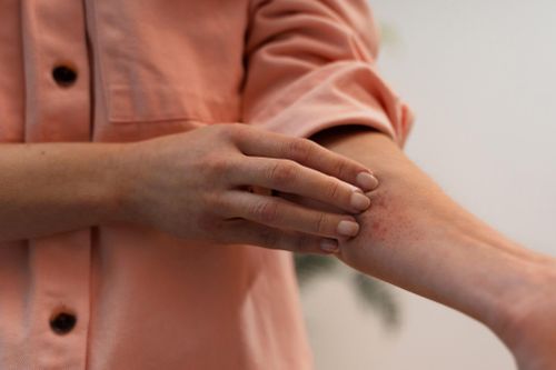 Dấu hiệu bạn đang sống chung với ký sinh trùng mà không biết