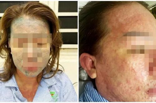 Nữ bệnh nhân nguy kịch sau khi dùng 'thuốc giảm cân thải độc, collagen không rõ nguồn gốc'