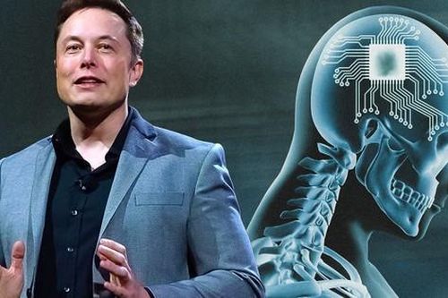 Tác dụng thần kỳ từ chip não của tỷ phú Elon Musk