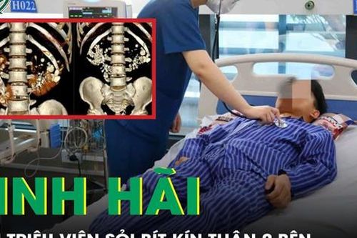 Suýt chạy thận cả đời vì chủ quan khiến hai bên thận ken đặc cả triệu viên sỏi