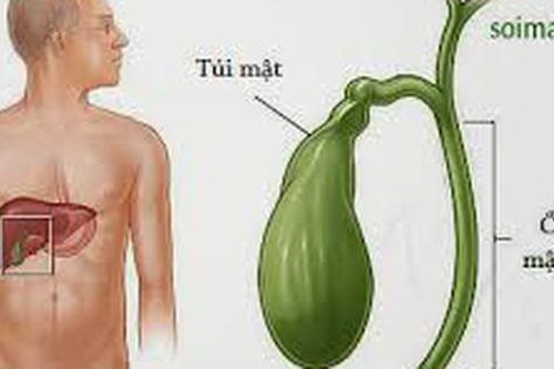 Ung thư túi mật có chữa khỏi không?