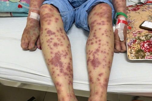 'Rước họa vào thân' từ những thói quen sử dụng thuốc, thực phẩm chức năng