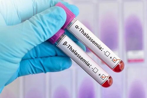 Phát hiện trẻ 19 tháng tuổi mang đột biến gene Thalassemia