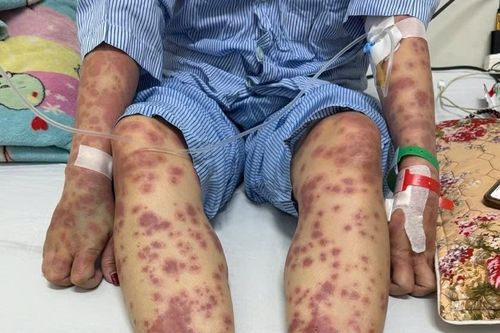 Suýt mất mạng vì 'thuốc giảm cân, collagen thải độc'