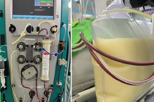 Chỉ đau bụng, buồn nôn, người phụ nữ không ngờ có chỉ số mỡ máu cao gấp 37 lần