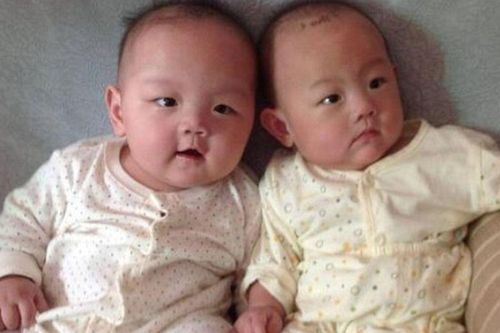 Sinh đôi nhưng diện mạo khác nhau, một bé da đen một bé da trắng, chồng lén vợ xét nghiệm ADN, kết quả khó tin