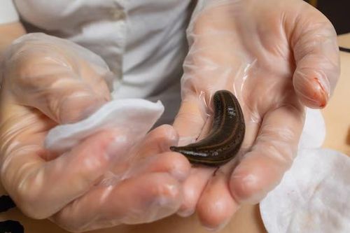 Người đàn ông bị đỉa chui vào niệu đạo khi đang làm việc ngoài đồng