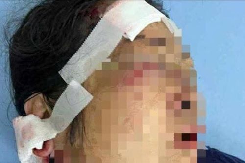 Truy tìm nhóm thanh niên hành hung 1 phụ nữ tại Phường Cam Ly-Đà Lạt