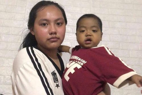 MS 1018: Sự sống mong manh của bé trai 21 tháng tuổi bị teo mật bẩm sinh, xơ gan