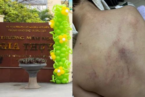 Nghi vấn giáo viên bạo hành trẻ tại trường Mầm non Gia Thụy: Sở GD&ĐT Hà Nội lên tiếng