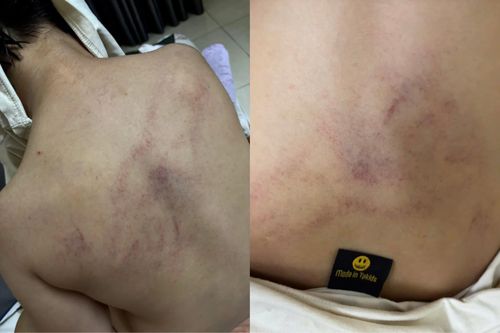 Phụ huynh tố con bị giáo viên 'đánh đập thô bạo, ném vào tường'