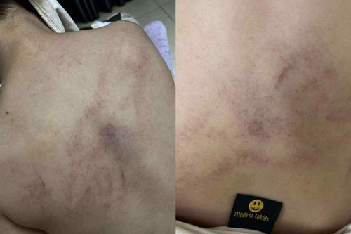 Giáo viên mầm non bạo hành bé gái 4 tuổi, Ban Giám hiệu 'sốc' khi xem lại camera