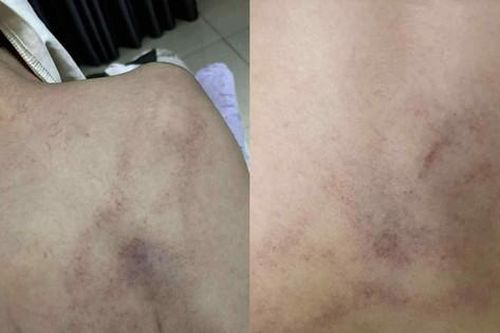 Xác minh thông tin bé gái 4 tuổi bị cô giáo đánh, kéo lê, ném vào tường