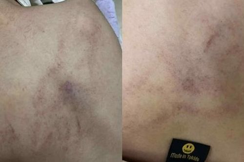 Hà Nội: Tạm đình chỉ giáo viên mầm non bạo hành bé gái