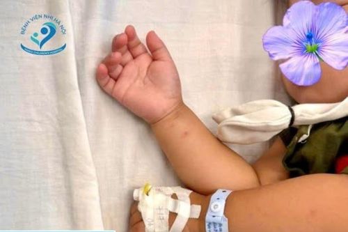 Cứu bé gái hơn 2 tuổi uống nhầm thuốc diệt nấm