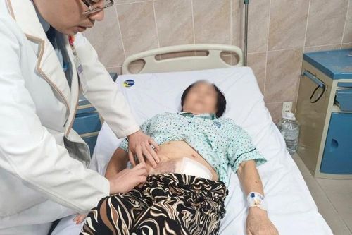 Ung thư đại tràng di căn vì chủ quan tưởng bệnh trĩ
