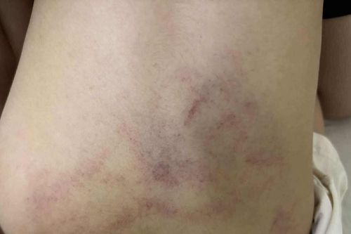 Bé gái bị đánh, kéo lê ở trường mầm non Hà Nội: Tạm đình chỉ giáo viên chứng kiến nhưng mặc kệ