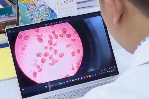 Nhiễm giun sán từ thú cưng