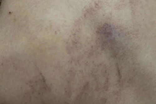 Vụ bé gái 4 tuổi bị đánh, ném vào tường ở Hà Nội: Cô giáo bạo hành nói gì?