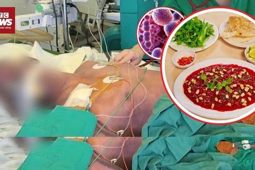 Vi khuẩn liên cầu lợn có thể giết bạn trong 24h
