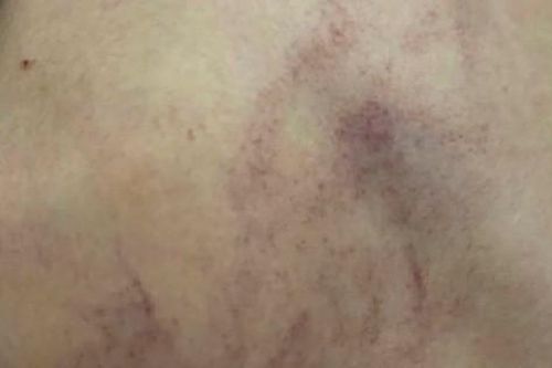 Đình chỉ 2 giáo viên vụ bạo hành trẻ ở Trường Mầm non