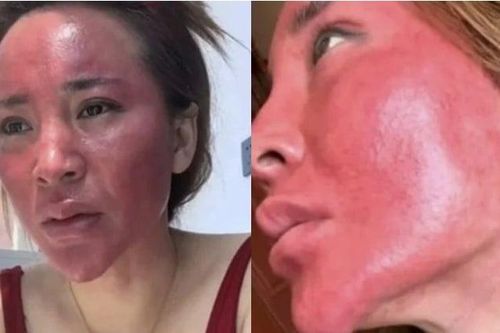 Gương mặt biến dạng vì 22 năm không tẩy trang