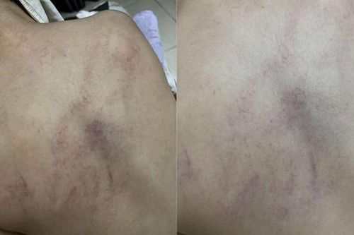 Vụ bé gái 4 tuổi bị đánh, ném vào tường: Cả 2 giáo viên là viên chức, có trình độ Đại học sư phạm