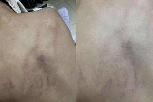 Vụ bé gái 4 tuổi bị đánh, ném vào tường: Cục Bà mẹ và Trẻ em đề nghị xử lý nghiêm