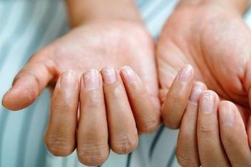 Bổ sung vitamin và khoáng chất nào khi móng tay giòn, dễ gãy?